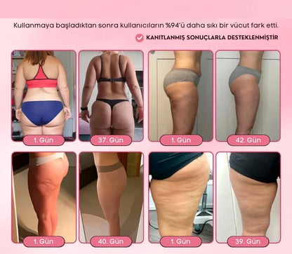 Vroxen™Anti Selülit Ve Sıkılaştırıcı Külotlu Çorap