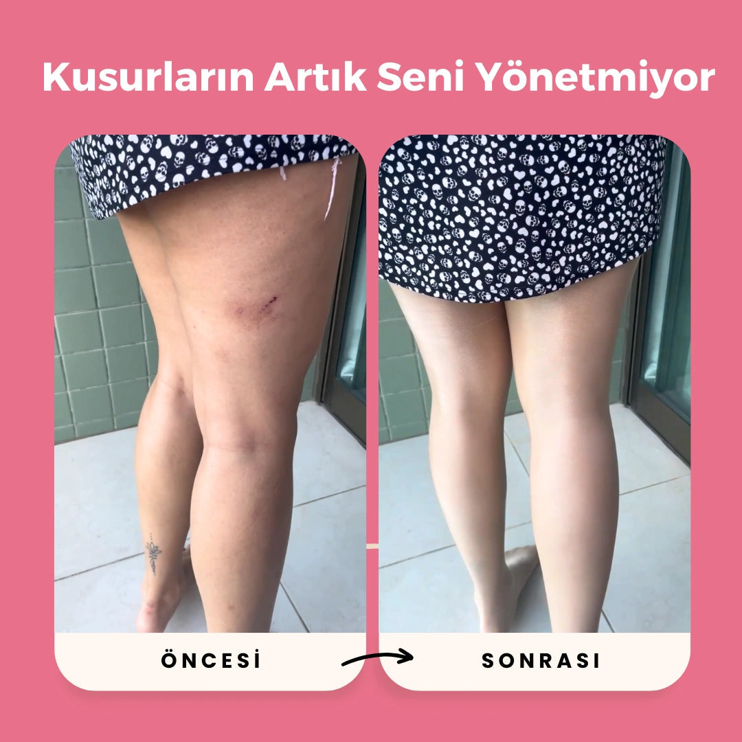Vroxen™Anti Selülit Ve Sıkılaştırıcı Külotlu Çorap
